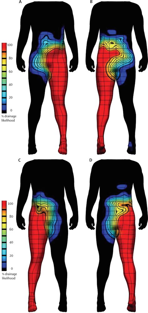Three Dimensional Visualisation Of Lymphatic Drainage Patterns In