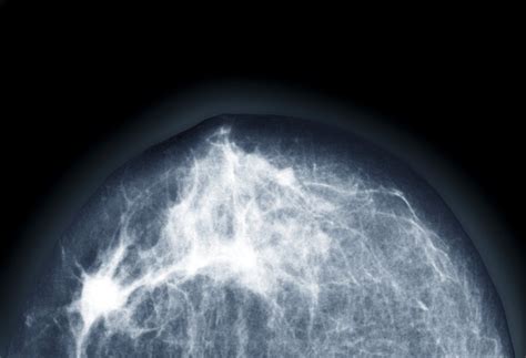 New Mammogram Recommendations A Guide The New York Times