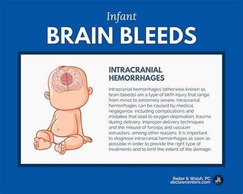 Learn About Infant Brain Bleeds Including Causes Treatments And
