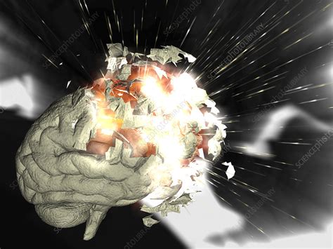 Exploding Brain Stock Image P3250149 Science Photo Library