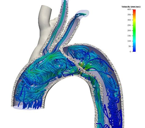 Fluid Structure Interaction Fsi A Practical Perspective — Eostrack