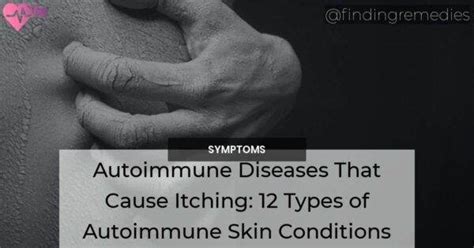 Autoimmune Diseases That Cause Itching 12 Types Of Autoimmune Skin