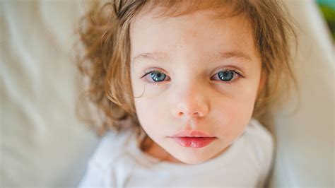 Pink Eye In Babies Symptoms Causes And Treatments