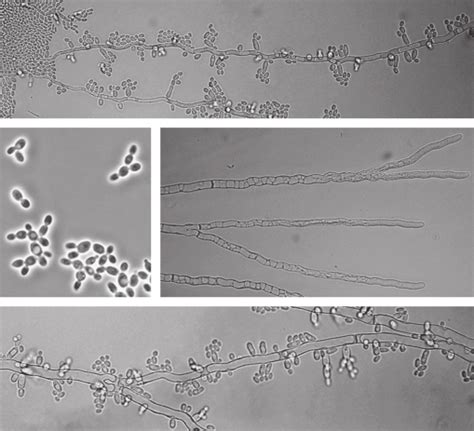 Microscopic Morphology A True Hyphae Growing From A Yeast Colony