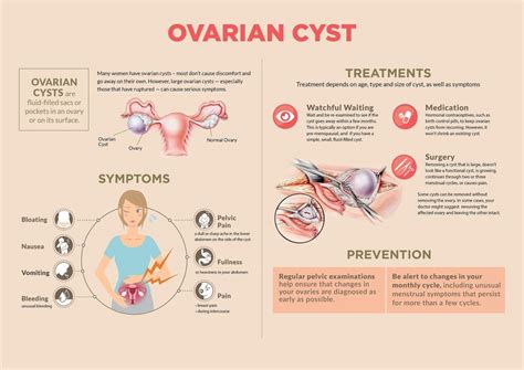 fb live session ovarian cysts dr rimmy singla mediclinic