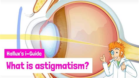 Halluxs I Guide What Is Astigmatism Fun Kids The Uks Childrens
