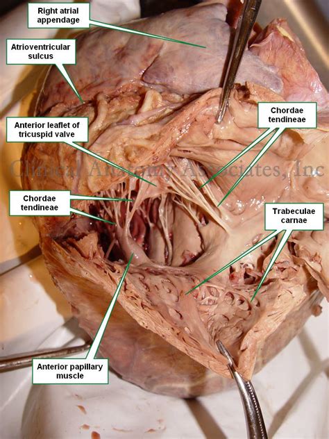 Chordae tendineae