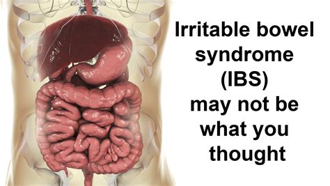 From that experience i'd say ibs, anxiety, stress, depression, diet, bowel cancer are related in some way. Irritable bowel syndrome (IBS) may not be what you thought ...