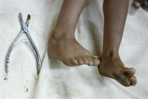 German Court Rules Religious Circumcision Of Minors Is Assault The