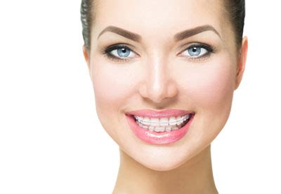 Clear Braces A Proven Method For Straightening Teeth Arc Advanced