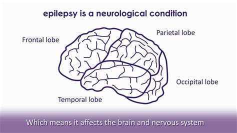 What Is Epilepsy Epilepsy Society Youtube