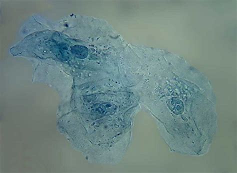 In a frog erythrocyte, you can see look for white blood cells, or leukocytes. The use of Brillant Blue #1 as a nuclear dye useful for ...