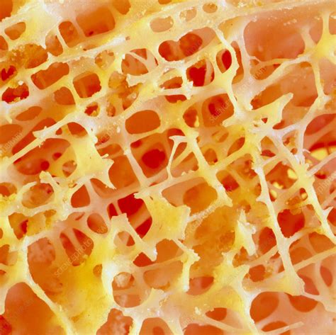 Normal Cancellous Spongy Bone From Upper Arm Stock Image P