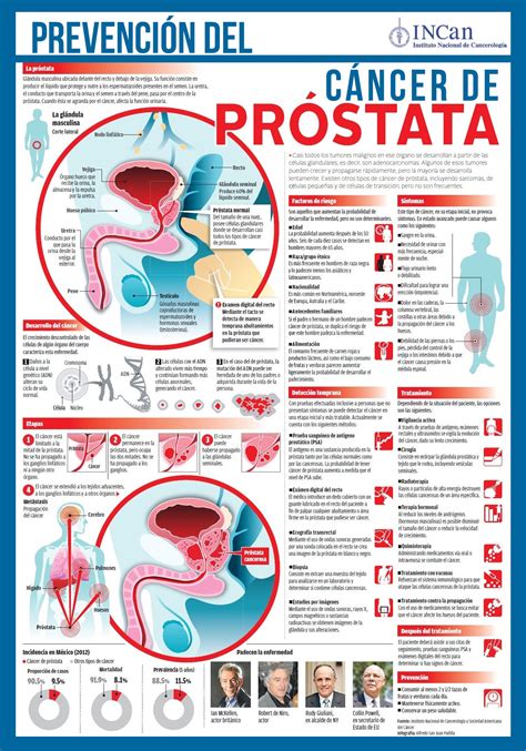 Prevención Del Cáncer De Próstata Oms Cancer De Prostata Avancado