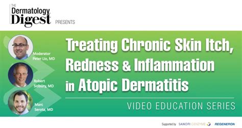 Treating Chronic Skin Itch Redness And Inflammation In Atopic