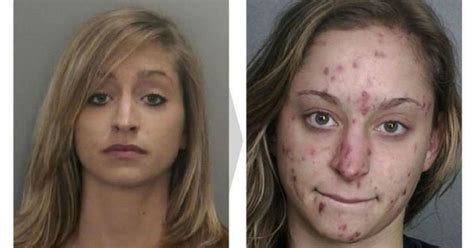 The Changing Faces Of Addicts New Photos Reveal The Shocking Effects