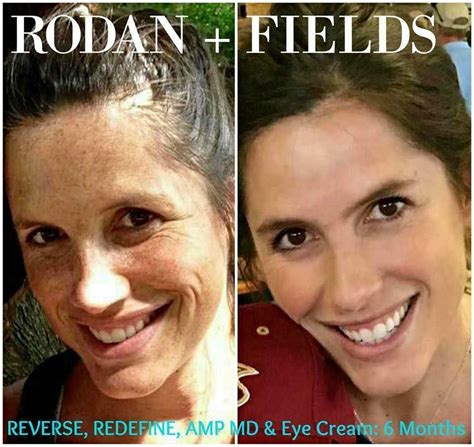 Rodan Fields Reverse Redefine Eye Cream Transform Your Skin