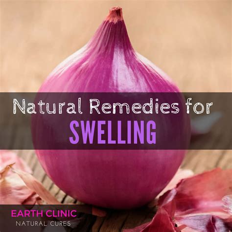Natural Remedies For Swelling From Injury
