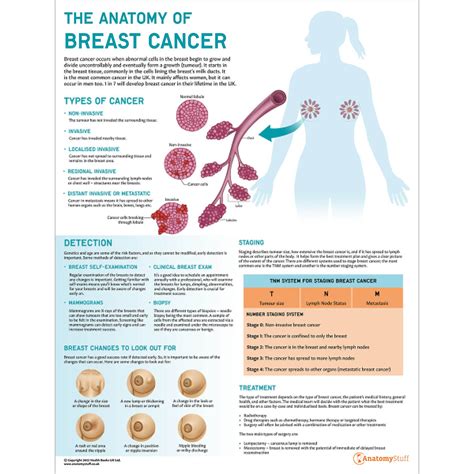 The Anatomy Of Breast Cancer Chart Breast Cancer Awareness Chart
