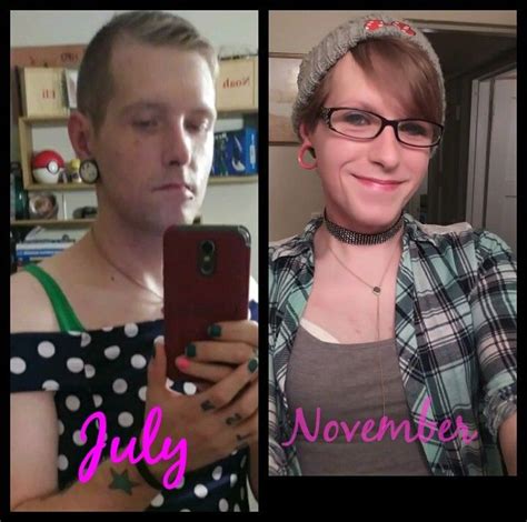 Albums 105 Pictures Mtf Hrt Before And After Pictures Updated