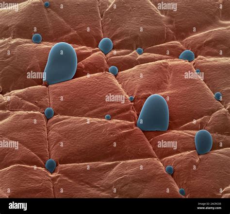 Skin Surface Coloured Scanning Electron Micrograph Sem Of Vapour