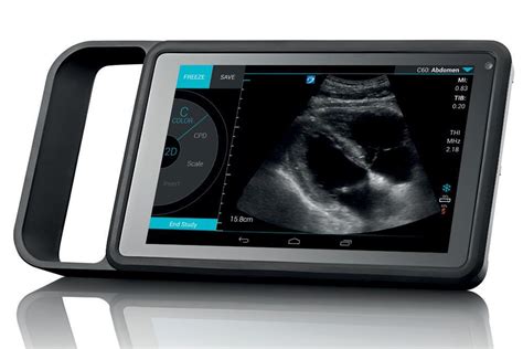 Sonosite Iviz Portable Ultrasound Machines Uds