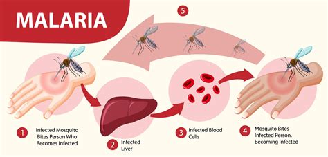 Malaria Symptom Information Infographic 1777983 Vector Art At Vecteezy