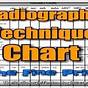 Digital X Ray Technique Chart