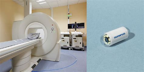 The Magnetically Guided Capsule Endoscopy System Developed By Siemens