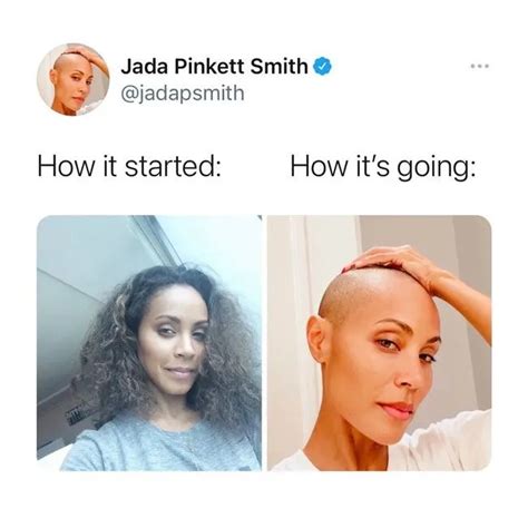 Jada Pinkett Smith Hair Loss Jada Pinkett Smith Was Open About Her