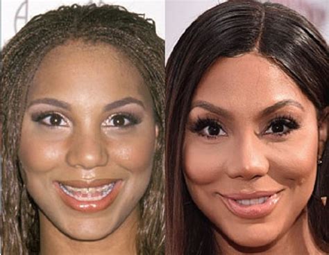 Tamar Braxton Plastic Surgeries And Tattoos Before And