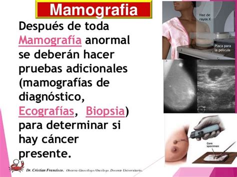 Metodos Diagnosticos De Ca De Mama Uce 2015