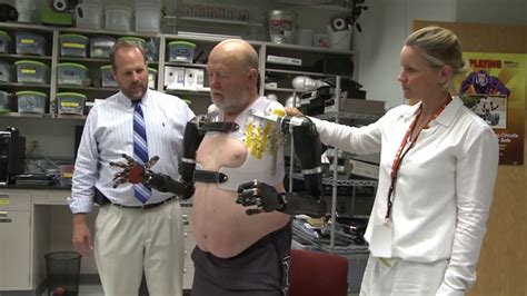 A Double Amputee Has Received Amazing Robot Arms And Its Not Science