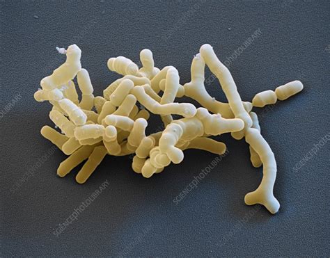 Bifidobacterium Bacteria Sem Stock Image C0357893 Science Photo