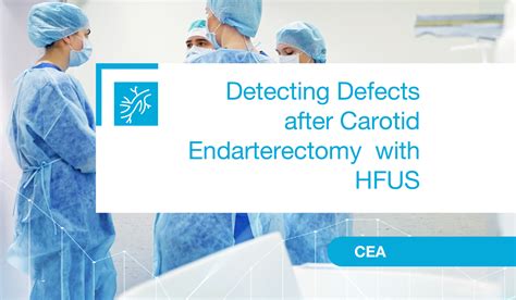 Detecting Defects After Carotid Endarterectomy A Comparison Between