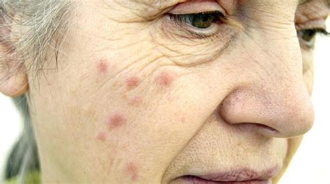 Common Skin Conditions At A Glance