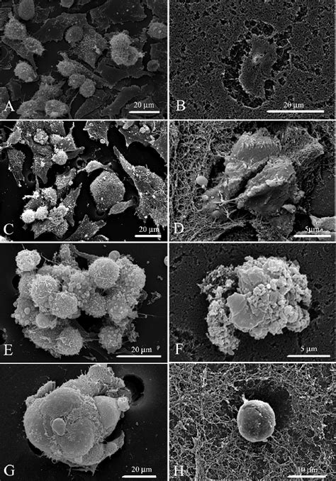 Scanning Electron Microscopy Sem Observations Of Tumor Cells Download Scientific Diagram