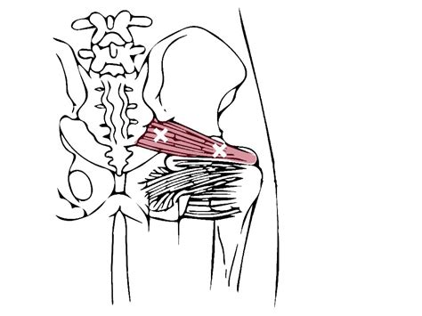 Trigger Points Piriformis Trigger Points And Referral Patterns