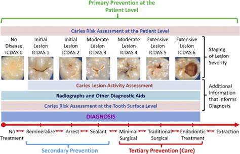 Pulpal And Periapical Diagnosis Chart