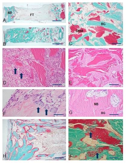 Histological Results A Typical Example Of All Dbm Group Notice Download Scientific Diagram