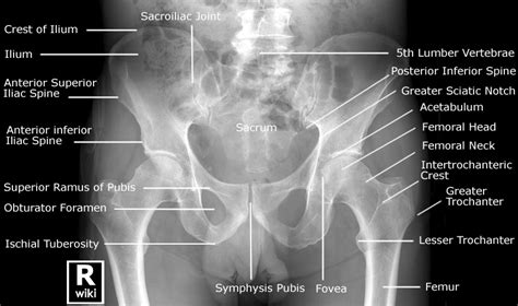 Pelvis Radiographic Anatomy Wikiradiography