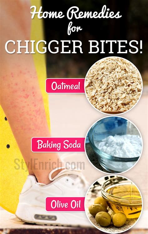 Home Remedies For Chigger Bites Which Can Provide Instant Relief