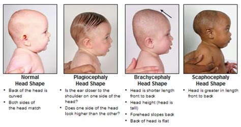 Maybe you would like to learn more about one of these? Guide to head shape | Head shapes, Baby face, Face