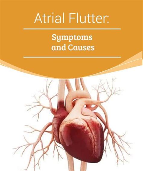 Atrial Flutter: Symptoms and Causes | Atrial flutter, Symptoms, Heart rhythm disorder