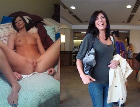 Before And After Pussy Spreaders Photos Xxx Porn Album