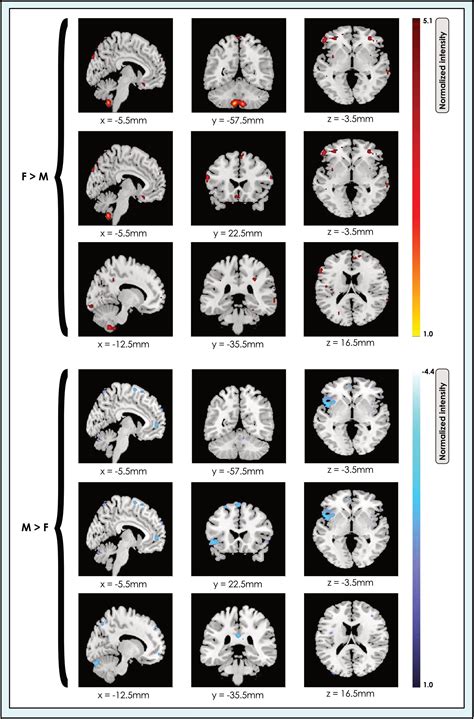 Frontiers Multilevel Mapping Of Sexual Dimorphism In Intrinsic Functional Brain Networks