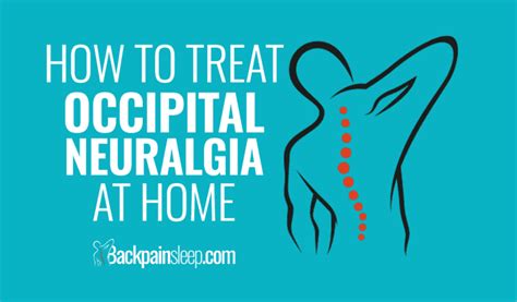Occipital Neuralgia Treatment At Home 3 Easy Methods 2023