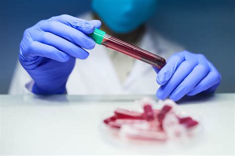 O Que é Vpn No Exame De Sangue