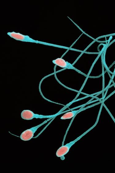Sperm Counts Worldwide Are Plummeting Faster Than We Thought
