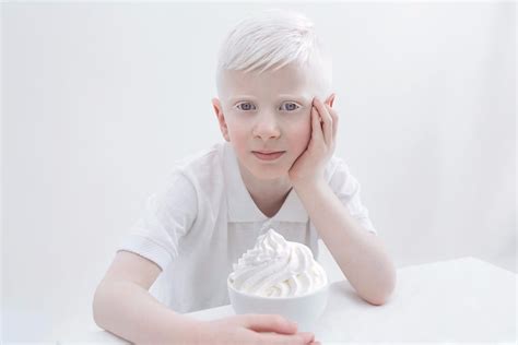 Szlachetne piękno albinosów na unikatowych fotografiach izraelskiej